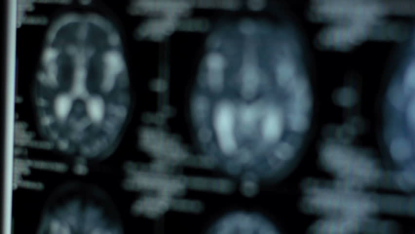 Tracking of a CT scan with on dark background