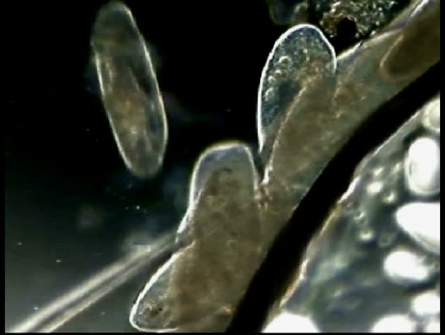 Paramecium crowding around a bubble.  Many micro organisms exhibit this bubble behavior, which may be related to a higher concentration of oxygen at a bubble interface.  Magnification 200x