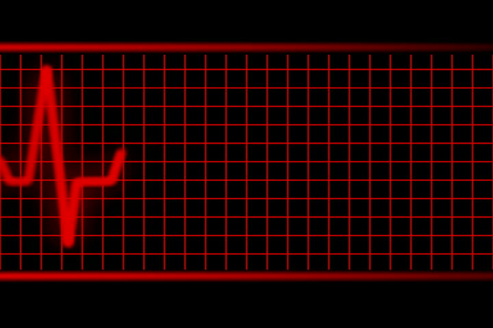 Red EKG Machine NTSC loopable interlaced