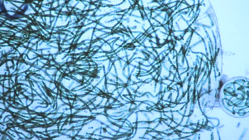 Microscopic view of sacks or bubbles containing chains of blue green algae moving around the culture