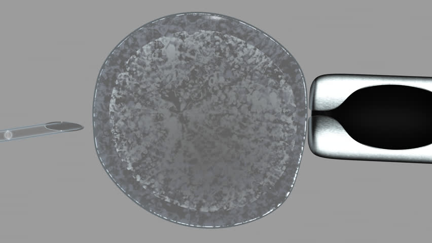 in vitro fertilization animation