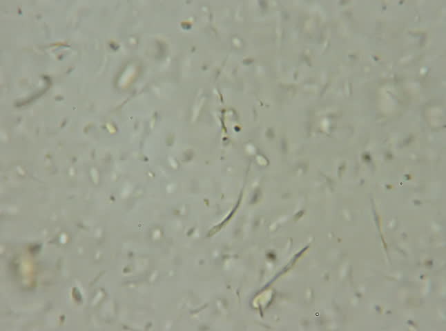 Assorted Bacteria 600x. Microscope 600x view of bacteria swimming in an infection sample. 