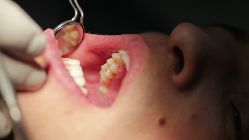 Close-up of patient open mouth during oral checkup