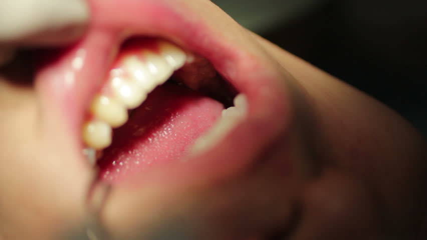 Close-up of patient open mouth during oral checkup