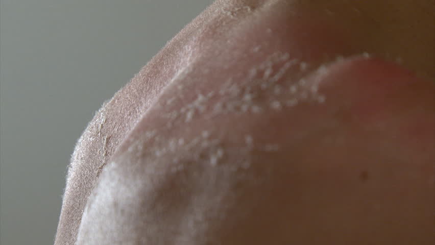 Boy peeling skin