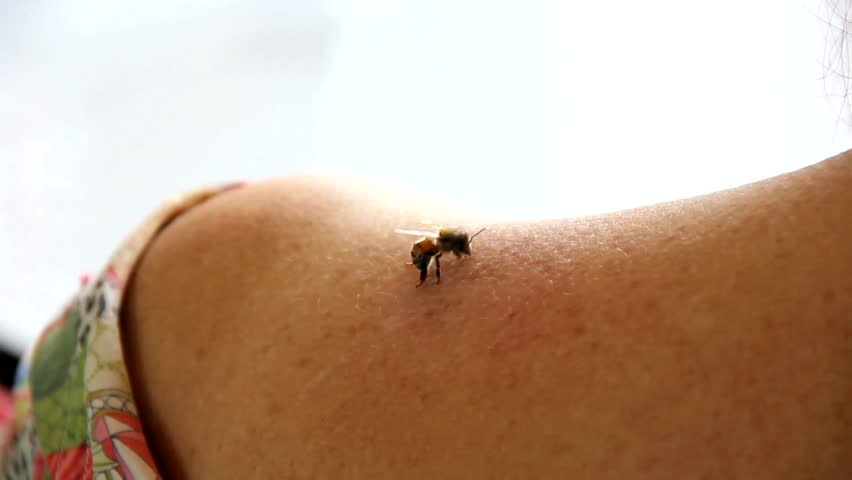 Bee is stinging old woman for treatment