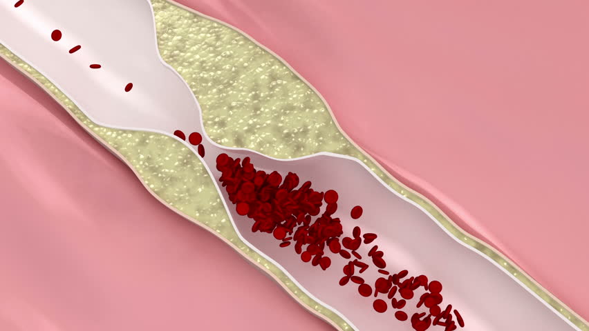 Header of disease
