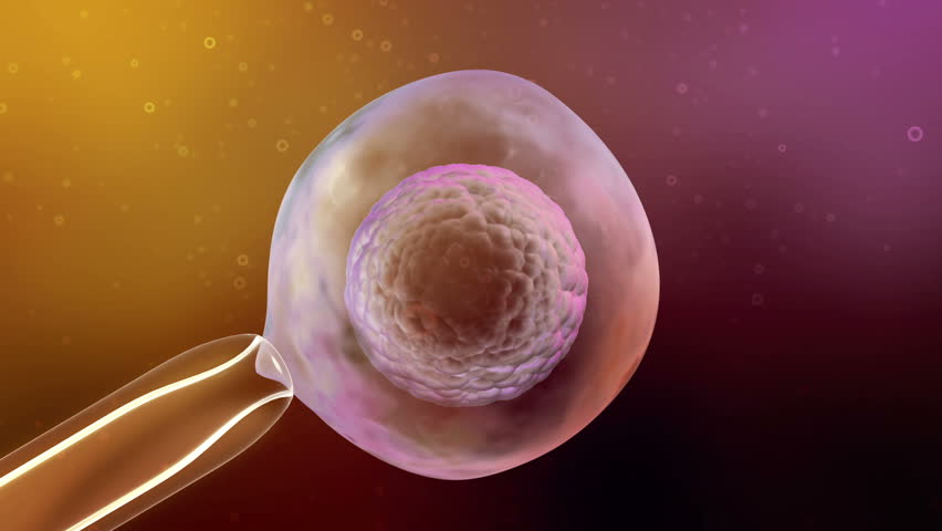 In Vitro Fertilization