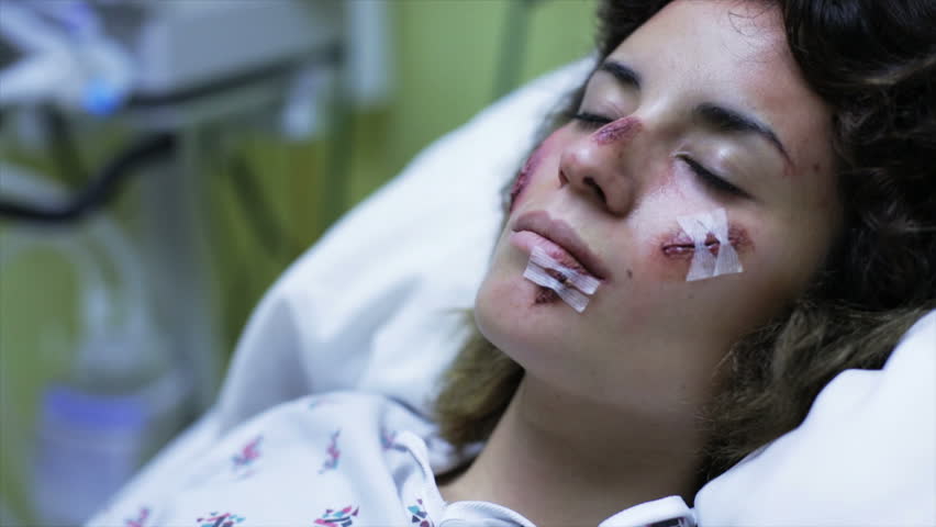 Female patient in recovery room in hospital after accident