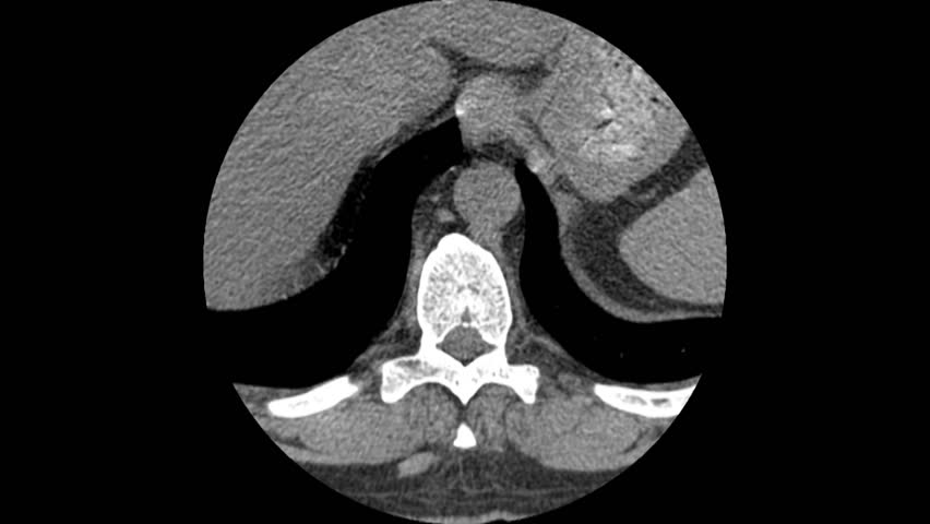 Original CT scan of human spine