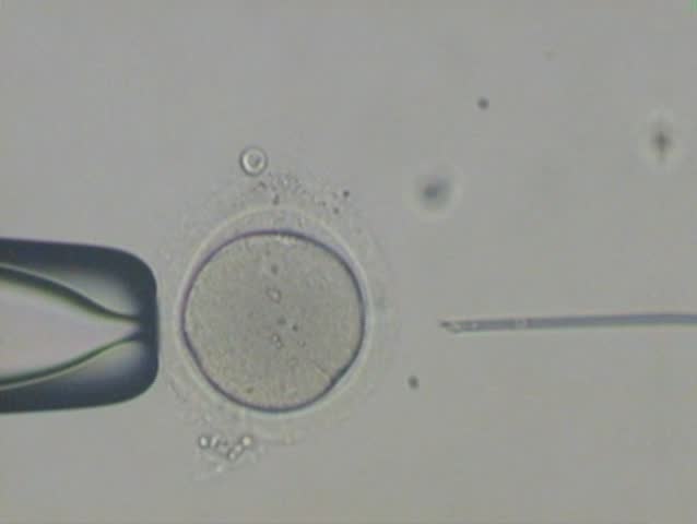 Intracytoplasmic sperm injection. Shot from a camera built into a microscope.