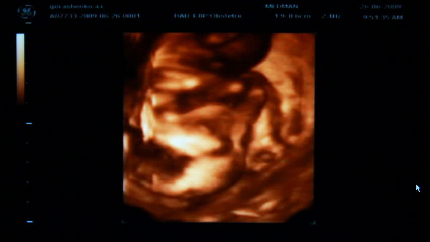 baby ultrasound video