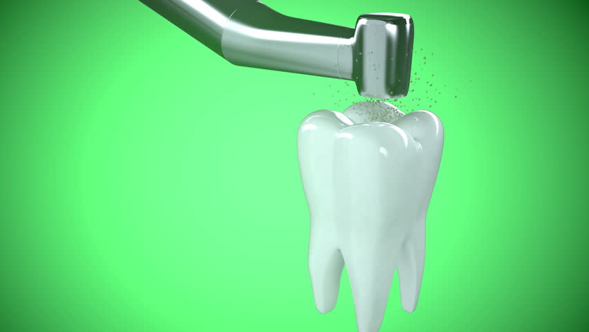 Close-up of treating unhealthy tooth with a drill.
