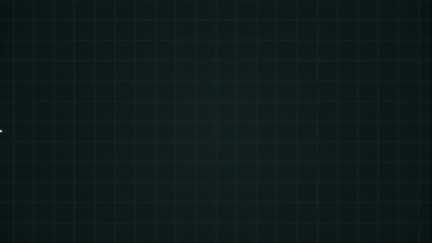 Dark green Electrocardiogram (EKG or ECG) showing pulsating hearth beat. The beat slows down and flatlines. Which shows someone dying.  