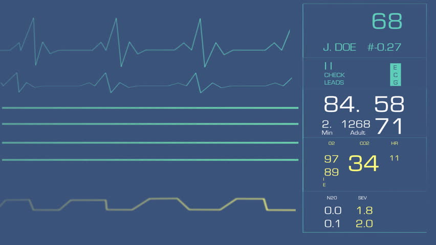 Heart Monitor - Animation