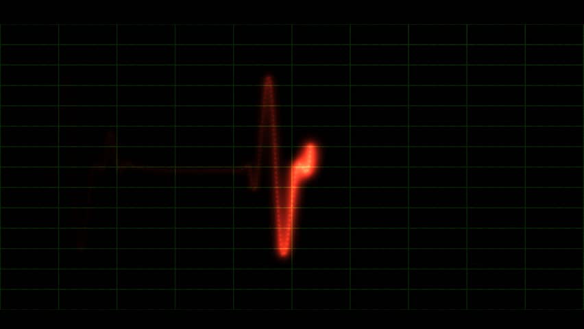Seamlessly looping heart monitor