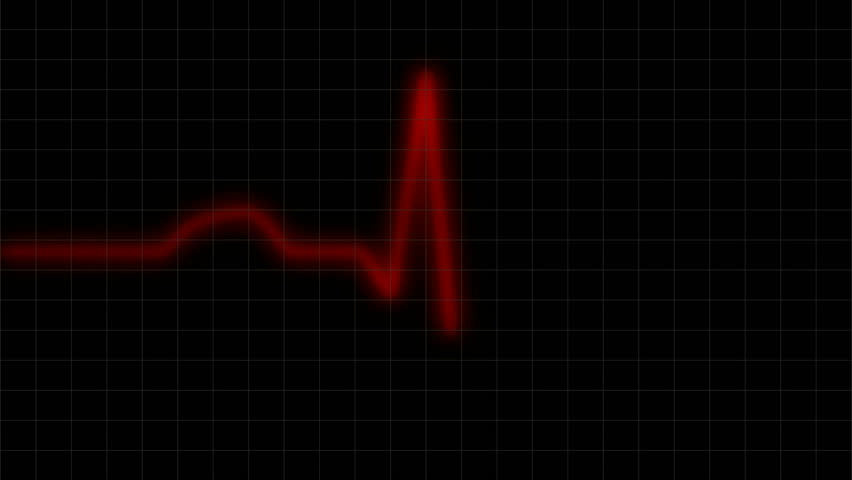 HD ECG / EKG-curve. A typical ECG tracing of a normal heartbeat (or cardiac cycle) consists of a P wave, a QRS complex and a T wave. Red line with monitor grid.