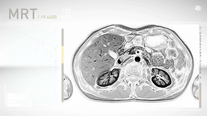 MRI / MRT Screendesign