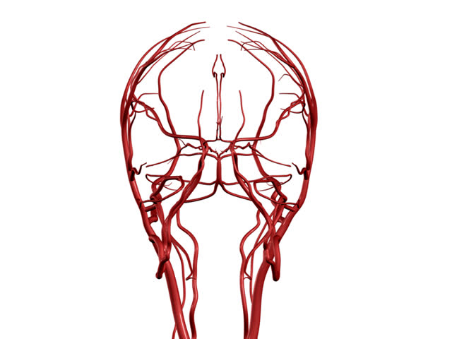 Brain Arteries PAL