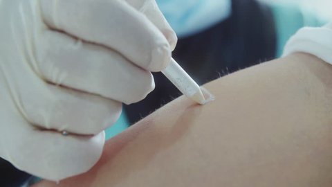Procedure Of Laser Hair Removal Stock Footage Video 100 Royalty