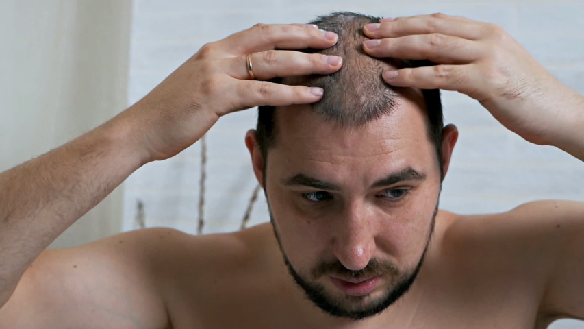 Hd00 27fight Against Hair Loss In Men Shots To The Head Treatment