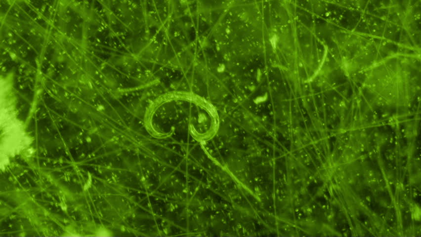 Stock video of nematode worm coiling in microscope view | 11199350 ...