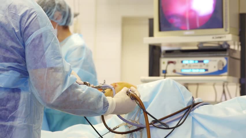 Hands Of Doctor During Endoscopy Surgery On Knee Joint Stock Footage ...