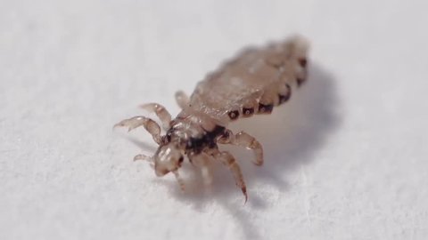 Head Lice Stock Video Footage - 4K and HD Video Clips ...