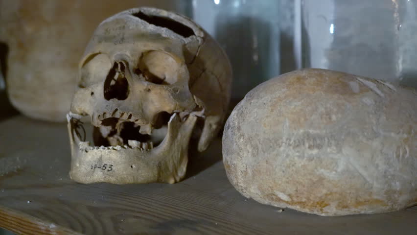 Header of lobotomy