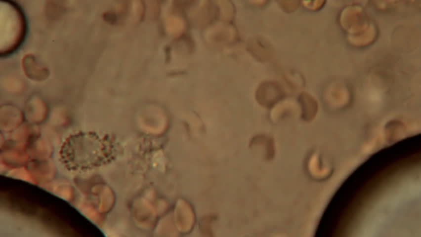 antibody repertoire from dried blood spot antibody repertoire from dried blood spot