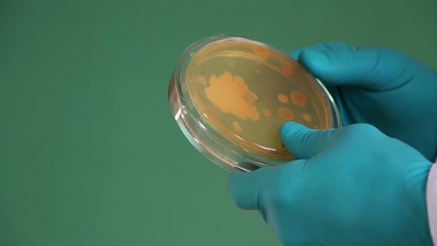 Header of peptone
