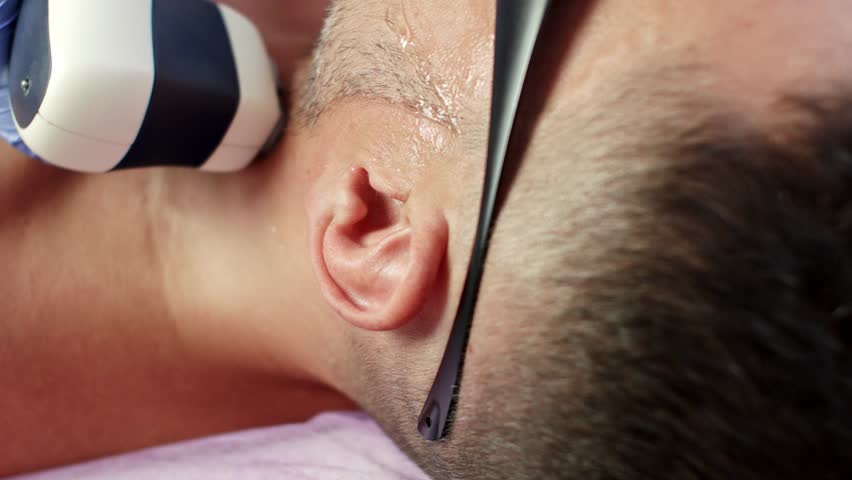 Man Getting Permanent Laser Face Hair Removal At Beauty Salon