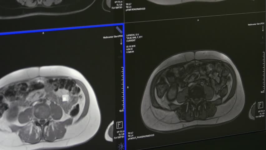 Header of tomography