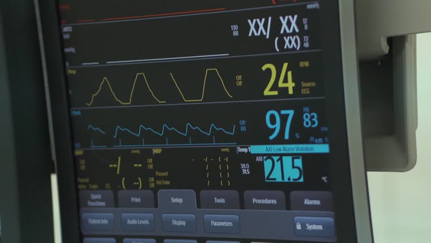 heart monitor hospital