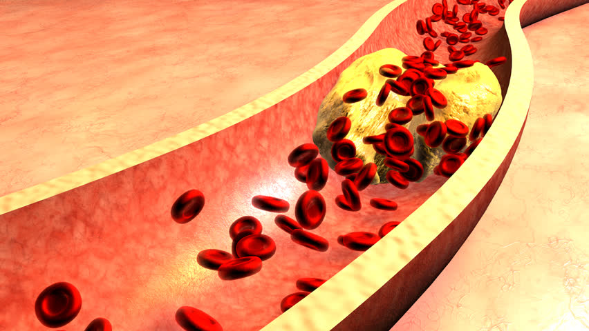 Image result for CHOLESTEROL hd images